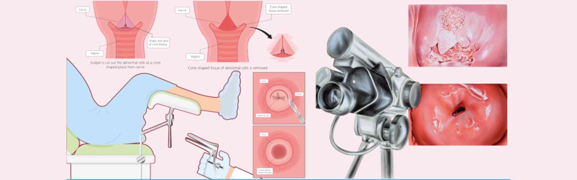 Best Hospitals for Colposcopy