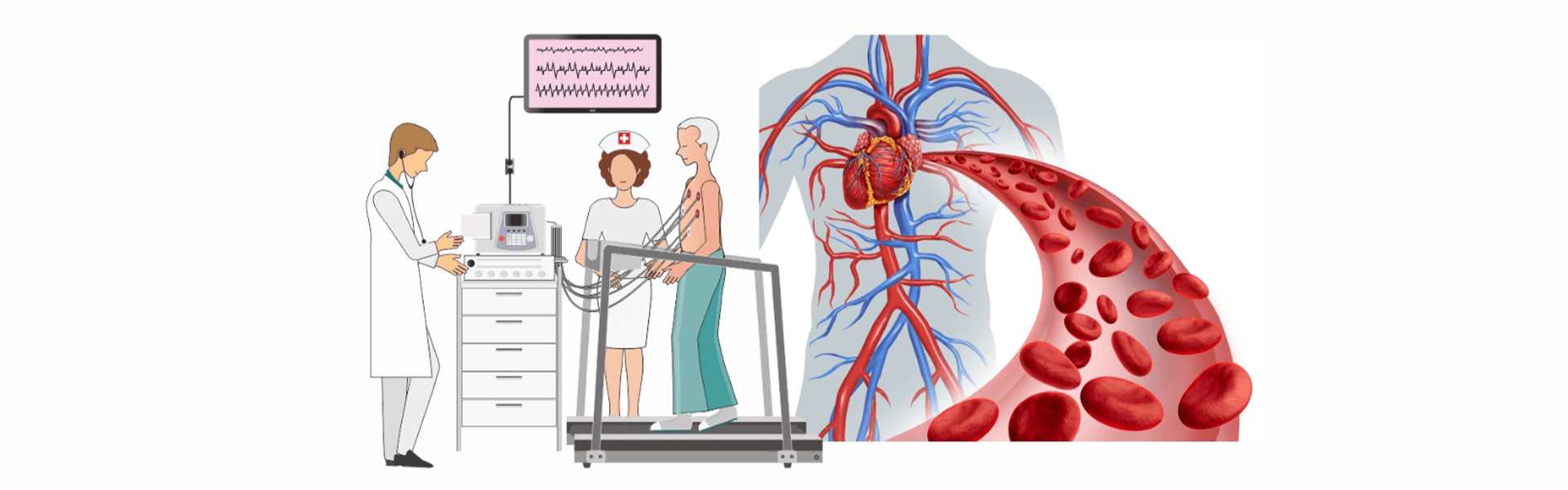 Myocardial Infusion Scan TMT Stress-Instructions Treatment in Bangalore