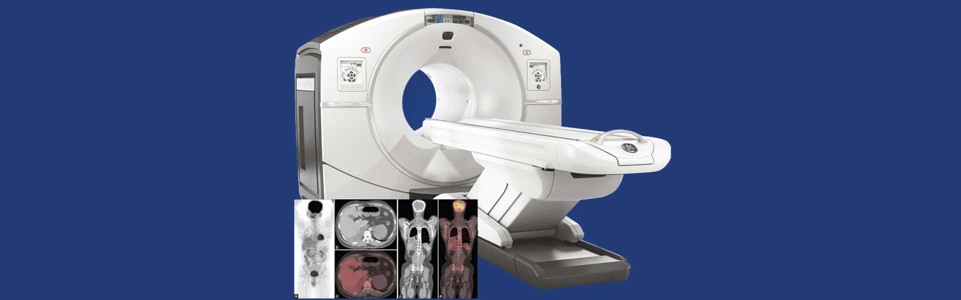 Whole Body-PET Scan in Bangalore