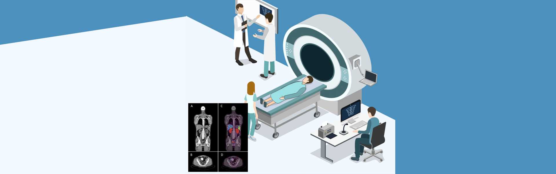 Best PSMA PET-CT Scan in Bangalore
