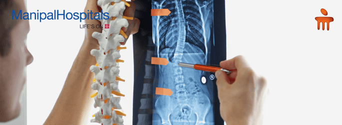 Best Spine Doctor In Bangalore